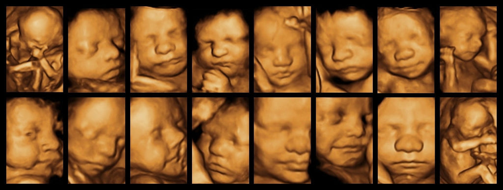 Watch Me Grow Bundle