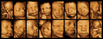 Watch Me Grow Bundle